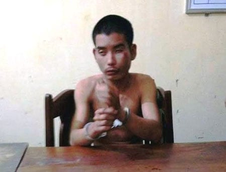 Mô tả ảnh.