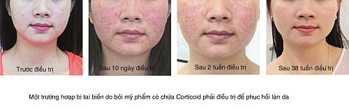 sự tàn phá Sh88bet đăng ký miễn phí