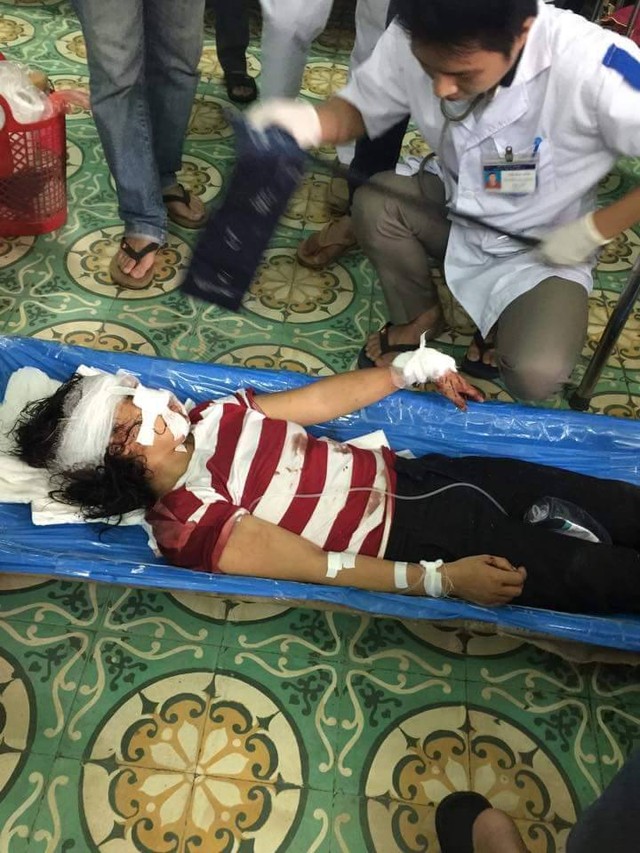 gan-tay-phunutoday-vn