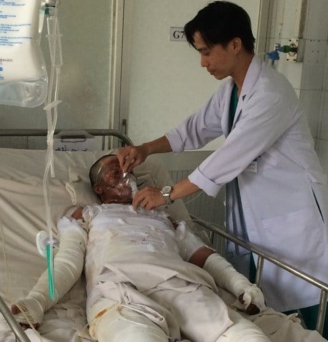 Mô tả ảnh.