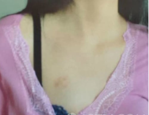 Mô tả ảnh.