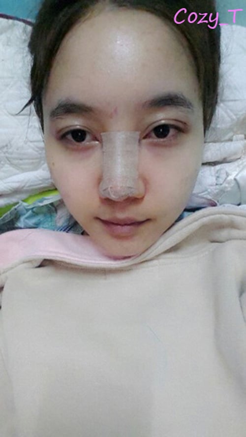 thiếu nữ mặt mụn