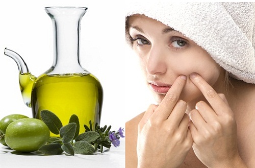 trị mụn trứng cá 
