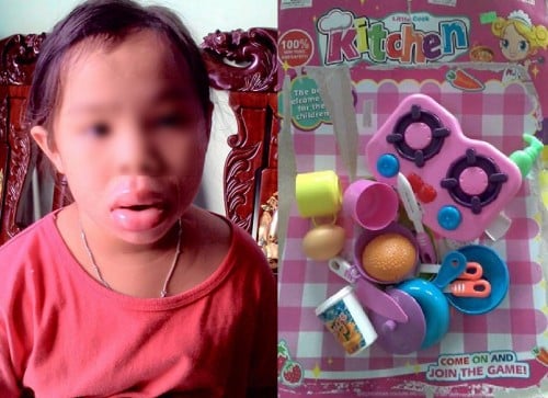 Bộ đồ chơi nấu ăn chứa chất độc gây dị ứng: