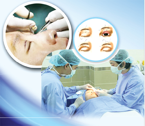 biến chứng do cắt mí