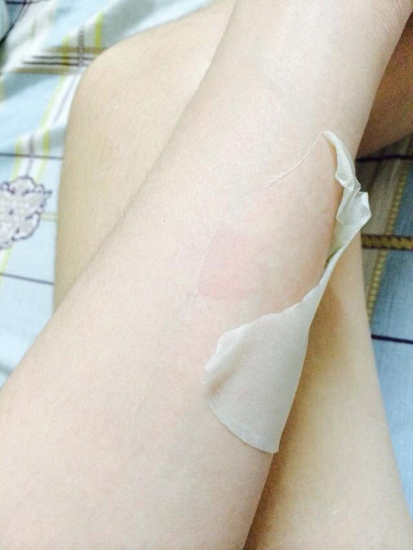tắm trắng nguy hiểm