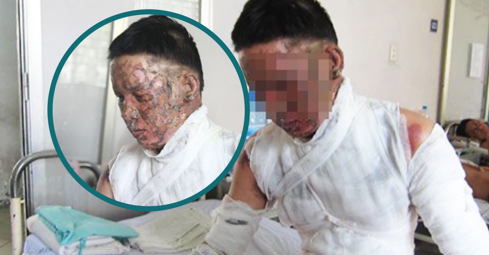 Nguy hiểm khôn lường khi ăn lẩu cồn 1