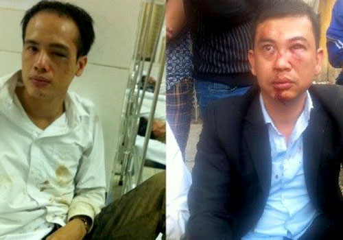 Khởi tố vụ 2 luật sư bị hành hung do chạy xe làm bắn bụi bẩn 