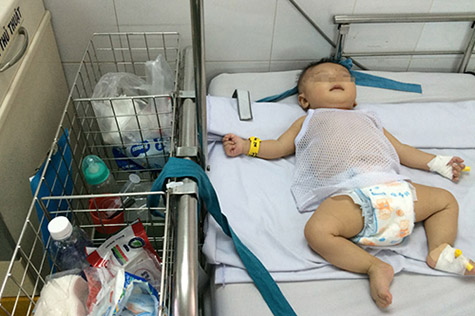Bé trai bị đâm xuyên hộp sọ: “Tiên lượng rất nặng”