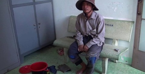 Giả tật nguyền đi ăn xin, mỗi tháng thanh niên trẻ kiếm 10 triệu