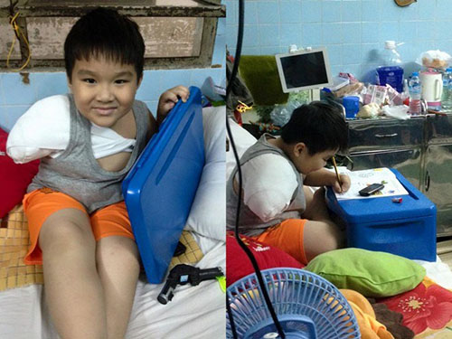 Em bé nghị lực dù trải qua nhiều lần Shbet888 tiền thưởng cực khủng sau tai nạn