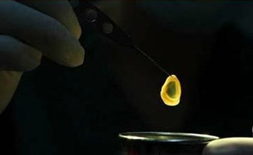 Quá trình hiến tặng giác mạc của me bé 9 ngày tuổi