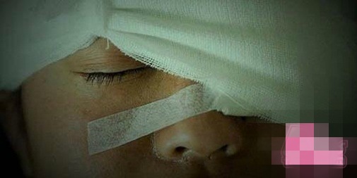 quá trình hiến tặng giác mạc của cậu bé 9 ngày tuổi