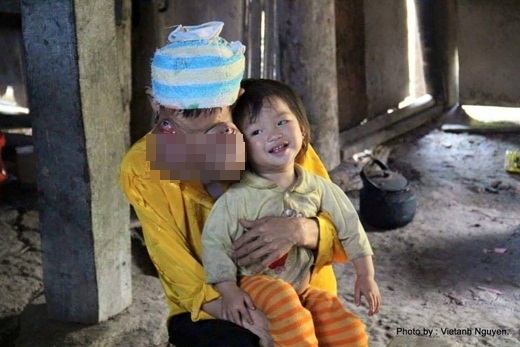 Bệnh lạ khiến những người đàn bà phải mang 