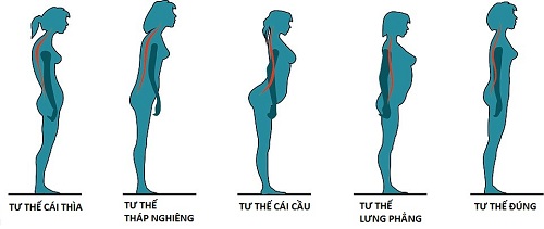 đau lưng