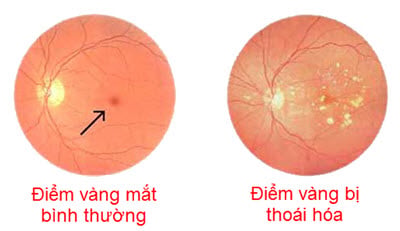 Mô tả ảnh.