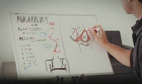thả rông vòng 1