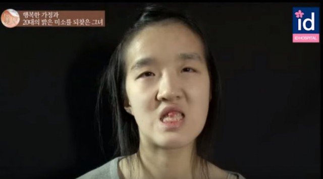 dao kéo