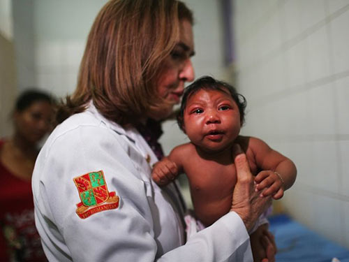 Nguồn nước hay virus Zika gây teo não