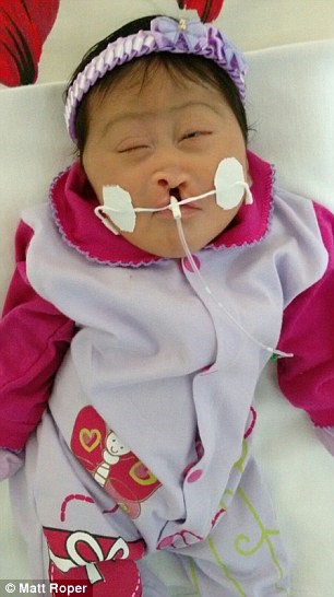 Những hình ảnh kinh hoàng giữa tâm dịch Zika gây teo não 