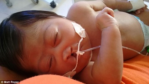 Những hình ảnh kinh hoàng giữa tâm dịch Zika gây teo não 