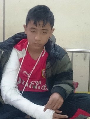 Học sinh lớp 8 bị thầy giáo đánh rạn xương tay