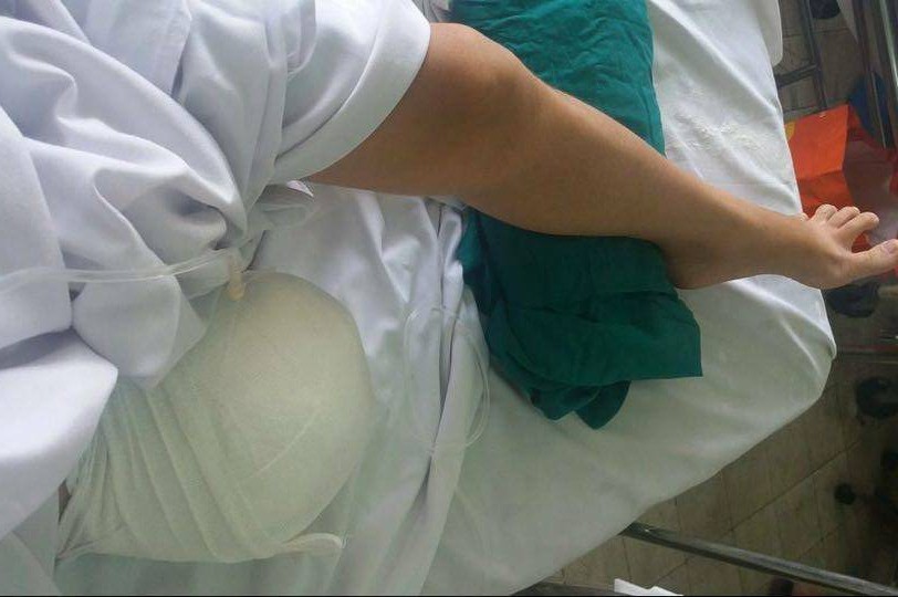 Bác sĩ tắc trách, nữ sinh lớp 10 phải cắt chân vì hoại tử