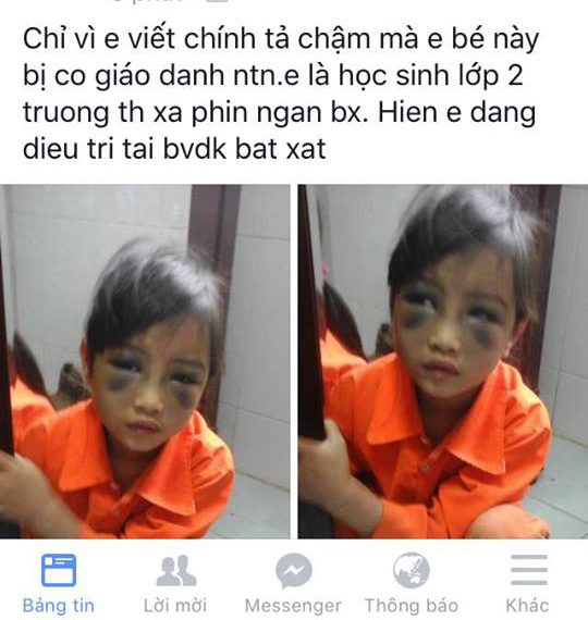 Mô tả ảnh.