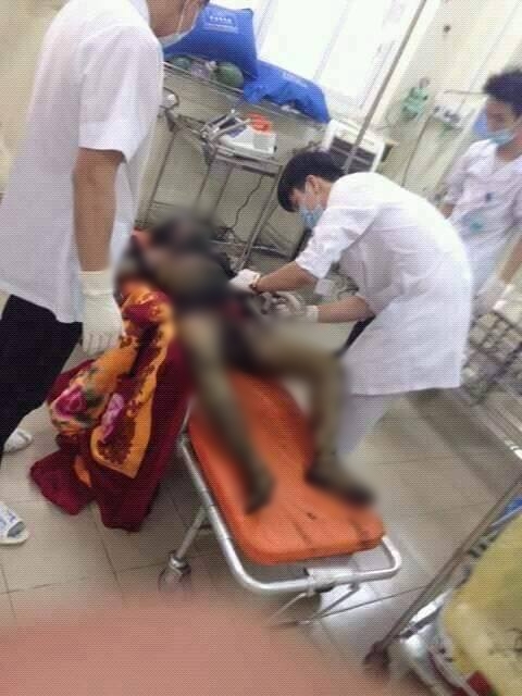 Nhà bất ngờ bốc cháy: Chồng bị thiêu sống, vợ nguy kịch