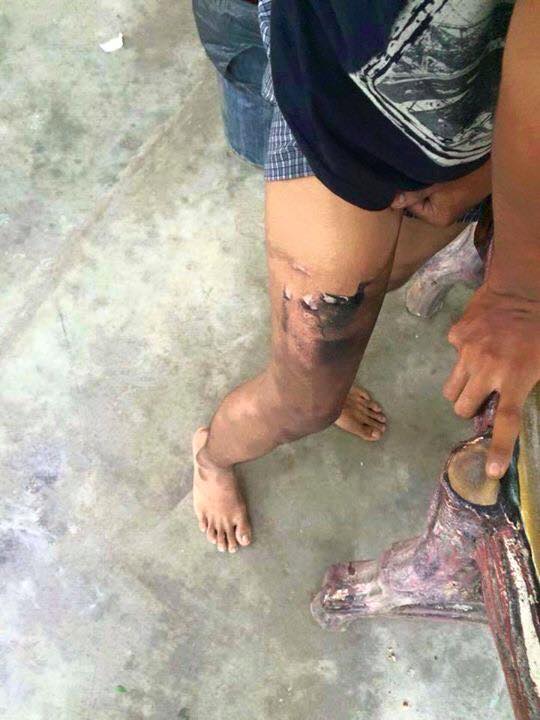 Mô tả ảnh.
