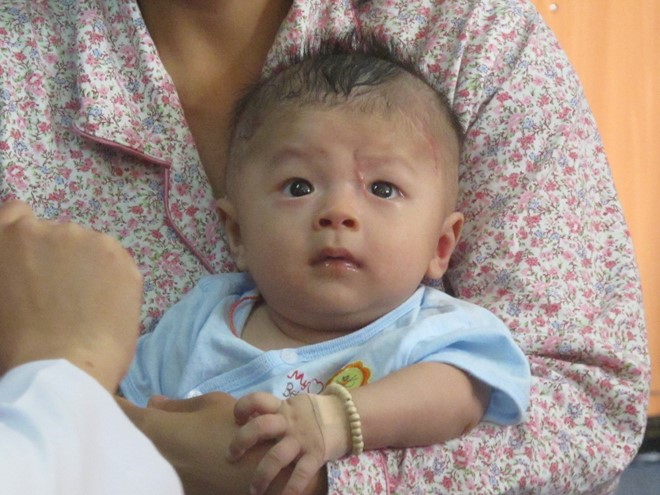 Mô tả ảnh.