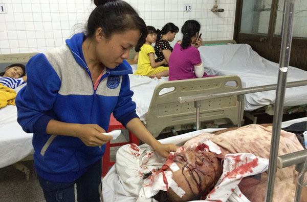 Đi mua đầu trâu, người đàn ông bị 10 người vây đánh nguy kịch