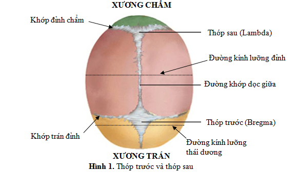 Mô tả ảnh.