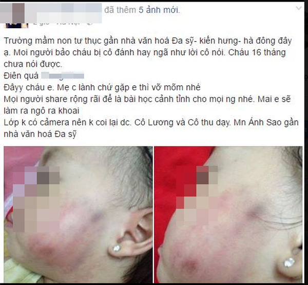 Mô tả ảnh.
