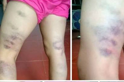 Tin phụ nữ ngày 28/5: Nguyên nhân khiến 7 trẻ tử vong vì bệnh lạ