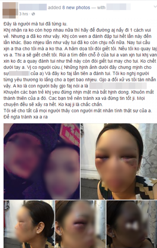 Mô tả ảnh.