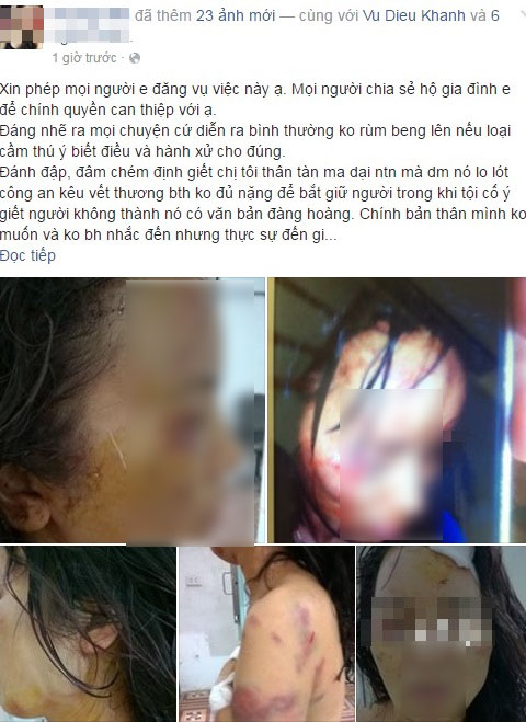 Mô tả ảnh.