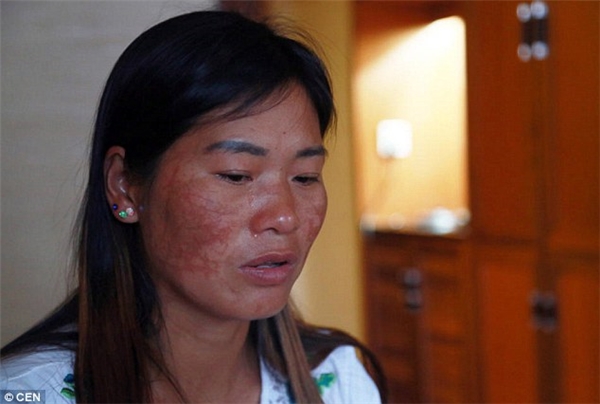 Mô tả ảnh.