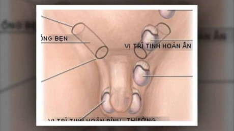 nuôi con