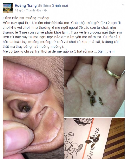 Bé trai 4 tuổi suýt thủng màng nhĩ chỉ vì chơi trò “nghịch cát”