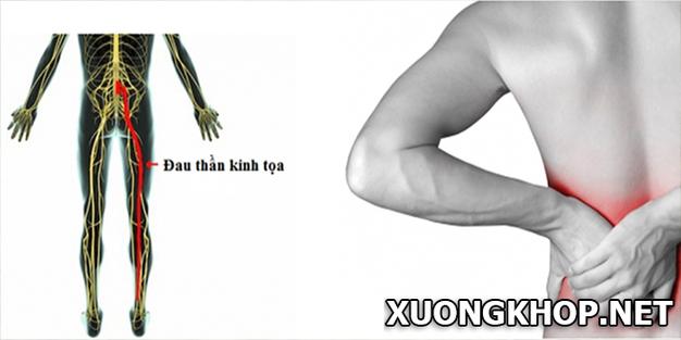 Mô tả ảnh.