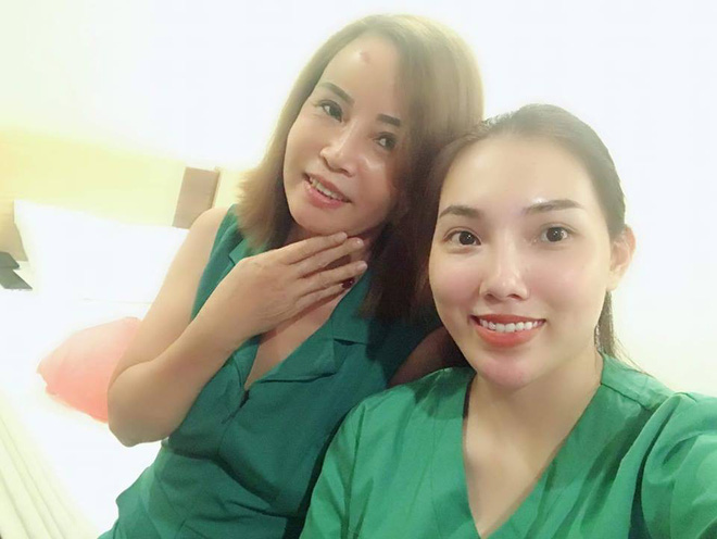 Co-dau-62-tuoi-khoe-nhan-sac-hoan-chinh-sau-khi-tan-trang-co-dau-62-sau-tham-my-1-1540278428-694-width660height496