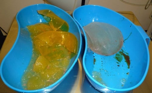 Những mảnh silicon bị vỡ.