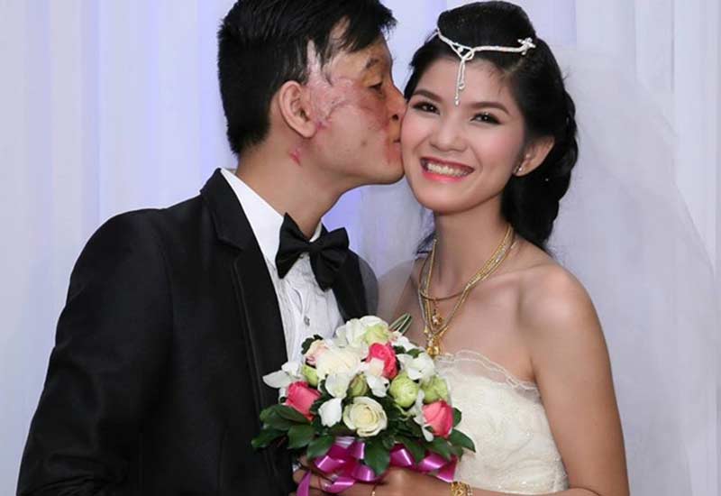 Hình cưới của cặp đôi chồng xấu vợ xinh từng gây xôn xao năm 2014.
