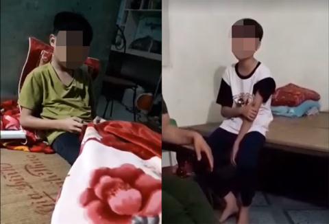 Em học sinh bị cô giáo T. đánh gây thương tích. Ảnh: GĐVN