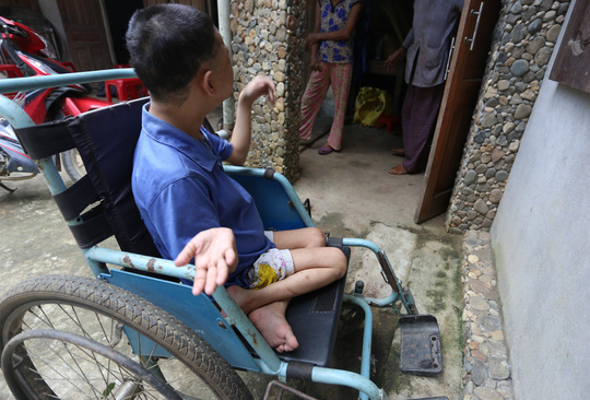 Chị P. bị bại liệt ngồi trên xe lăn.