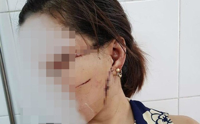 Người phụ nữ bị chồng 