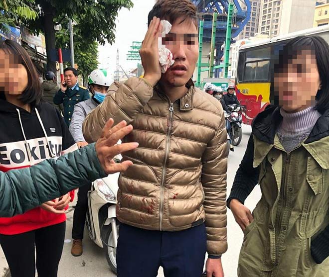 Nam hành khách bị đánh chảy máu đầu.