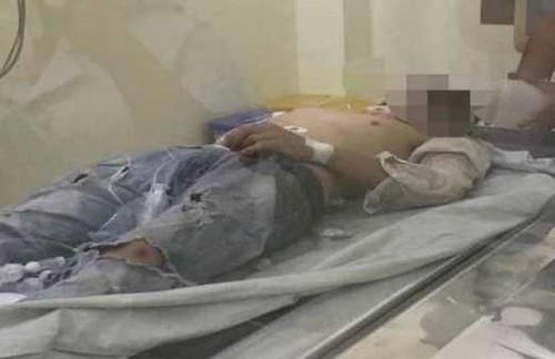 Nam thanh niên đang được điều trị tại bệnh viện.