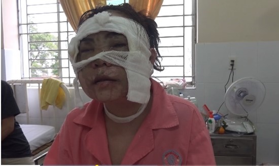 Chị N. đang điều trị tại bệnh viện.